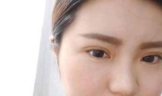 双眼皮抽脂价格 双眼皮抽脂价格